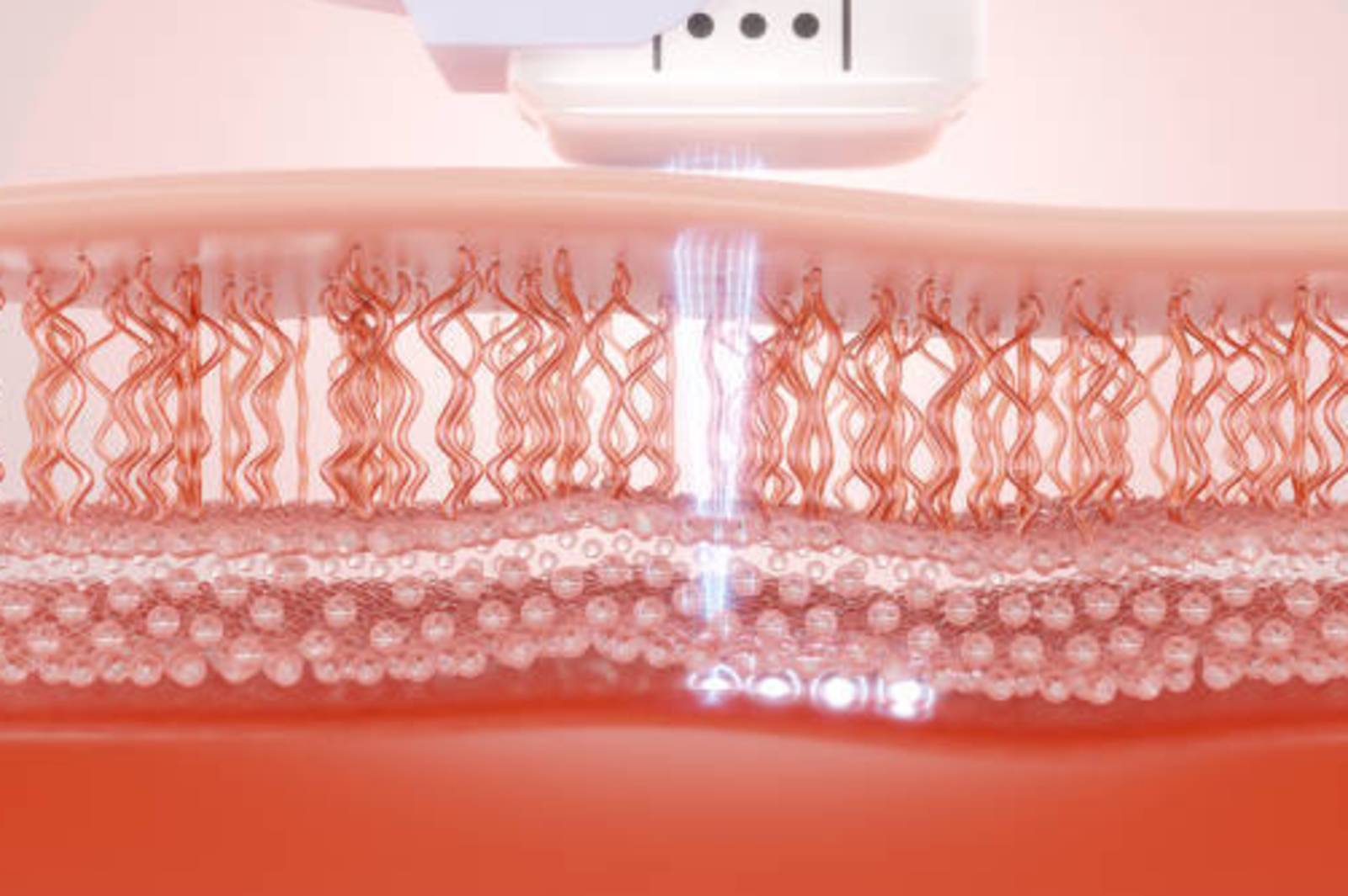 聚焦超音波－聲音也能殺死癌細胞?